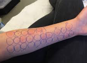 Allergy Testing Centre